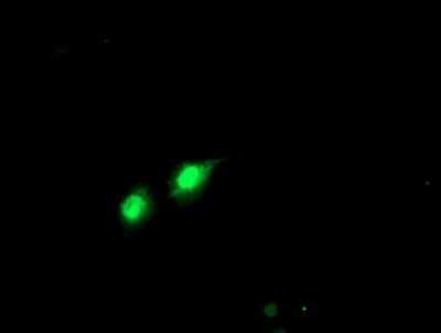 Immunocytochemistry/ Immunofluorescence: PHF21B Antibody (OTI3D1) - Azide and BSA Free [NBP2-73367]