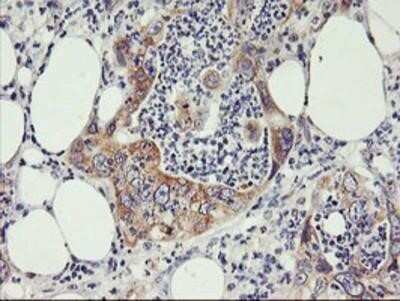 Immunohistochemistry: PHF21B Antibody (OTI3D1) - Azide and BSA Free [NBP2-73367]