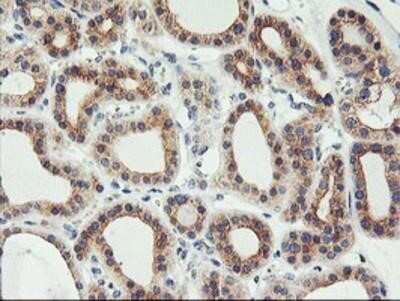 Immunohistochemistry: PHF21B Antibody (OTI3D1) - Azide and BSA Free [NBP2-73367]