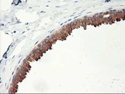 Immunohistochemistry: PHF21B Antibody (OTI3D1) - Azide and BSA Free [NBP2-73367]