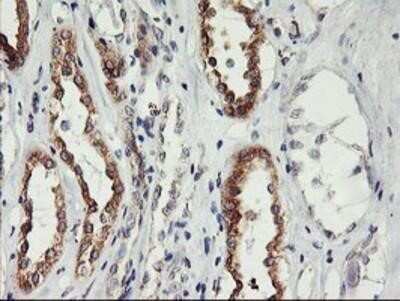 Immunohistochemistry: PHF21B Antibody (OTI3D1) - Azide and BSA Free [NBP2-73367]