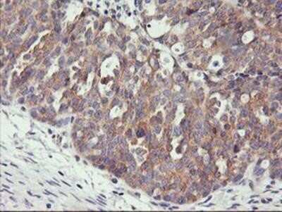 Immunohistochemistry-Paraffin: PHF21B Antibody (OTI3D1) [NBP2-00960]