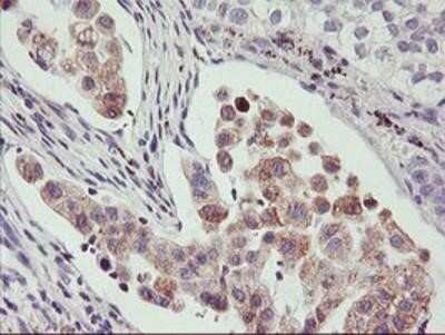 Immunohistochemistry-Paraffin: PHF21B Antibody (OTI3D1) [NBP2-00960]