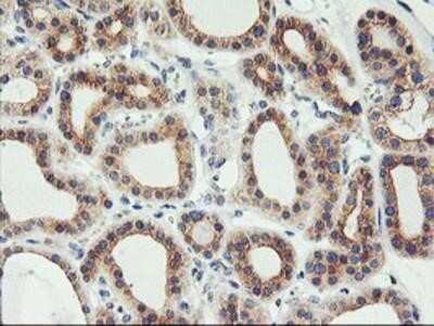 Immunohistochemistry-Paraffin: PHF21B Antibody (OTI3D1) [NBP2-00960]