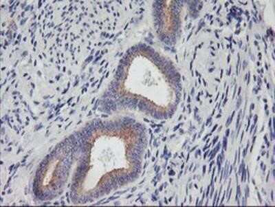 Immunohistochemistry-Paraffin: PHF21B Antibody (OTI3D1) [NBP2-00960]