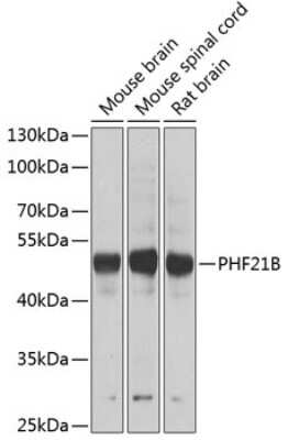 Western Blot: PHF21B AntibodyBSA Free [NBP2-94425]
