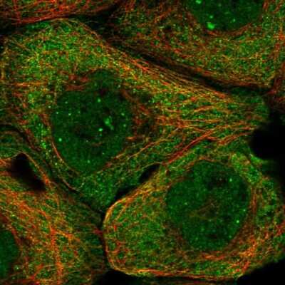 Immunocytochemistry/ Immunofluorescence: PHF22 Antibody [NBP1-92263]