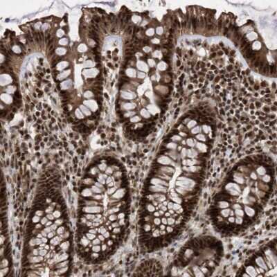 Immunohistochemistry-Paraffin: PHF22 Antibody [NBP1-92263]