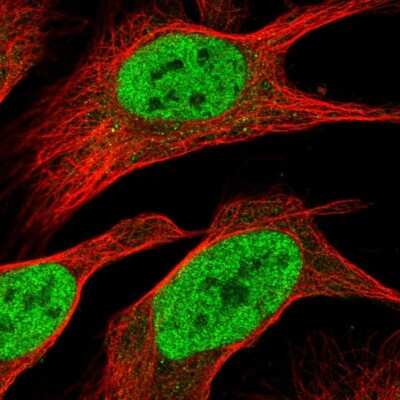 Immunocytochemistry/ Immunofluorescence: PHF23 Antibody [NBP2-13756]