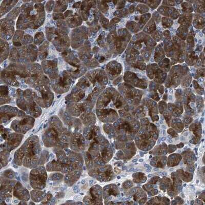 Immunohistochemistry-Paraffin: PHF24 Antibody [NBP1-90937]