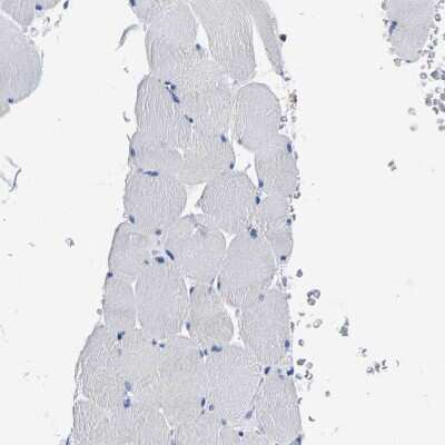 Immunohistochemistry-Paraffin: PHF24 Antibody [NBP1-90937]