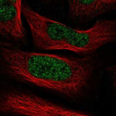 Immunocytochemistry/ Immunofluorescence: PHF5A Antibody [NBP1-88591]