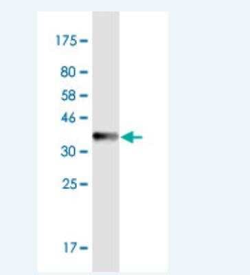 Western Blot: PHF6 Antibody (8F24) [H00084295-M01-100ug]