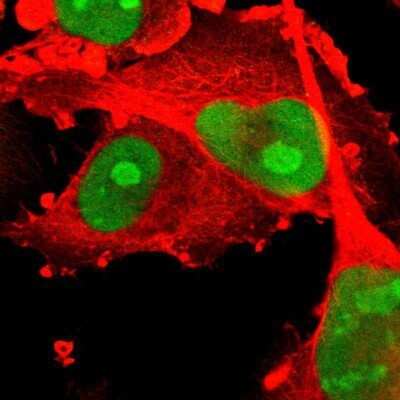 Immunocytochemistry/ Immunofluorescence: PHF6 Antibody [NBP1-88646]
