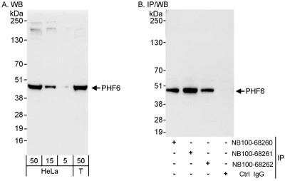 Western Blot: PHF6 Antibody [NB100-68260]
