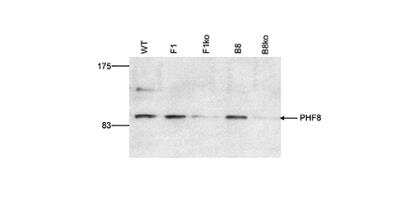 Western Blot: PHF8 Antibody [NBP2-62797]