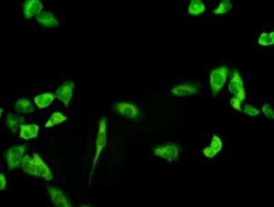 Immunocytochemistry/ Immunofluorescence: PHGDH Antibody (4A3-1D6) [H00026227-M01]