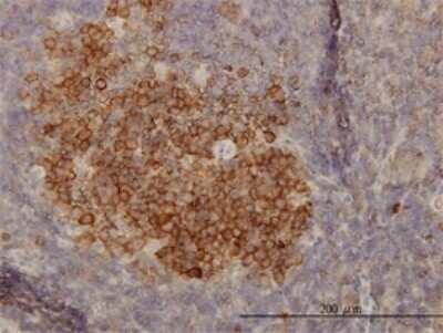 Immunohistochemistry-Paraffin: PHGDH Antibody (4A3-1D6) [H00026227-M01]
