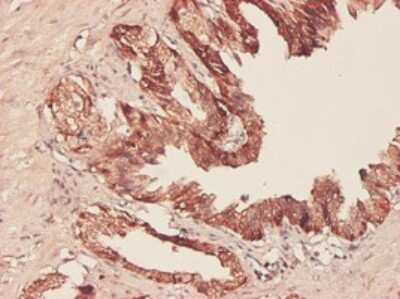 Immunohistochemistry-Paraffin: PHGDH Antibody (4A3-1D6) [H00026227-M01]