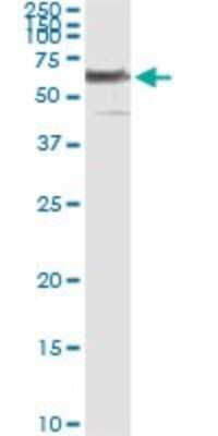 Immunoprecipitation: PHGDH Antibody (4A3-1D6) [H00026227-M01]