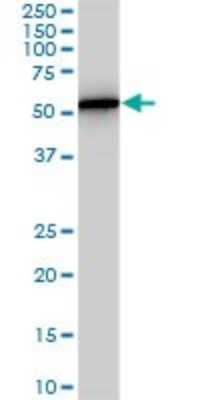 Western Blot: PHGDH Antibody (4A3-1D6) [H00026227-M01]