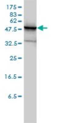 Western Blot: PHGDH Antibody (4A3-1D6) [H00026227-M01]