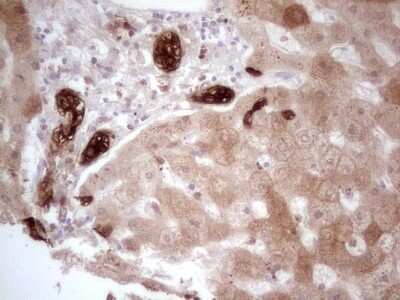 Immunohistochemistry: PHGDH Antibody (OTI5C4) [NBP2-46389]