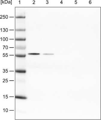 Western Blot: PHGDH Antibody (CL0555) [NBP2-52939]