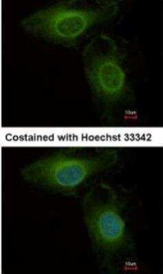 Immunocytochemistry/ Immunofluorescence: PHGDH Antibody [NBP1-32201]