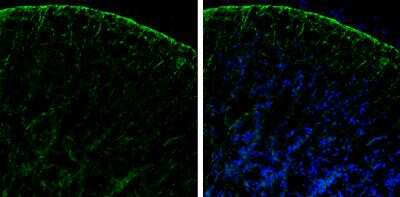 Immunocytochemistry/ Immunofluorescence: PHGDH Antibody [NBP1-32201]