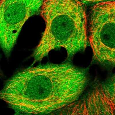 Immunocytochemistry/ Immunofluorescence: PHGDH Antibody [NBP1-87310]