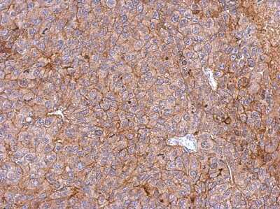 Immunohistochemistry-Paraffin: PHGDH Antibody [NBP1-32201]