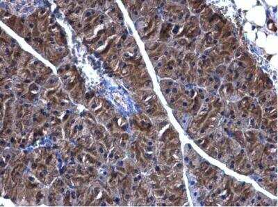 Immunohistochemistry-Paraffin: PHGDH Antibody [NBP1-32201]
