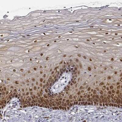 Immunohistochemistry-Paraffin: PHGDH Antibody [NBP1-87310]