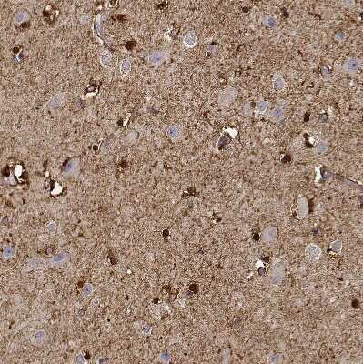 Immunohistochemistry-Paraffin: PHGDH Antibody [NBP1-87310]