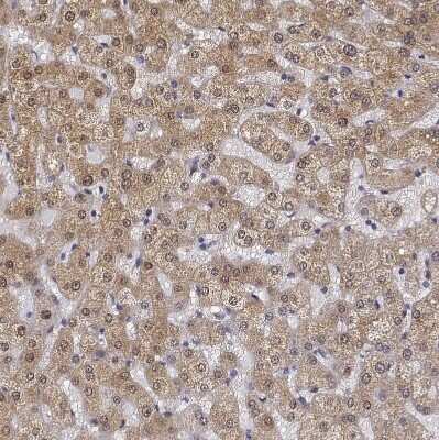 Immunohistochemistry-Paraffin: PHGDH Antibody [NBP1-87310]