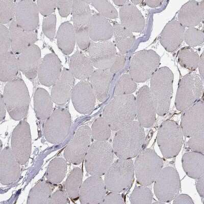 Immunohistochemistry-Paraffin: PHGDH Antibody [NBP1-87311]