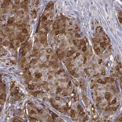 Immunohistochemistry-Paraffin: PHGDH Antibody [NBP1-87311]
