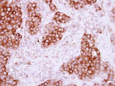 Immunohistochemistry-Paraffin: PHGDH Antibody [NBP2-19801]