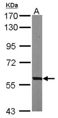 Western Blot: PHGDH Antibody [NBP1-32201]