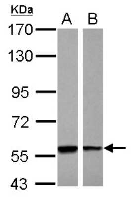 Western Blot: PHGDH Antibody [NBP2-19801]