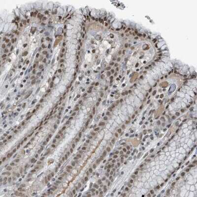 Immunohistochemistry-Paraffin: PHIP Antibody [NBP2-33886]