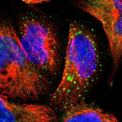 Immunocytochemistry/ Immunofluorescence: PHKA1 Antibody [NBP1-87281]