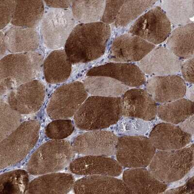 Immunohistochemistry-Paraffin: PHKA1 Antibody [NBP3-17109]