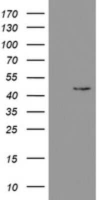 Western Blot: PHKG2 Antibody (OTI1F9) [NBP2-46393]