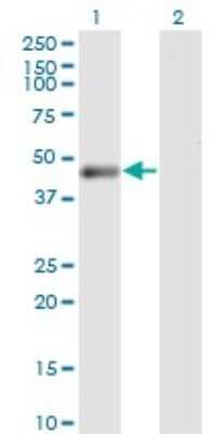 Western Blot: PHKG2 Antibody (2B8) [H00005261-M05]