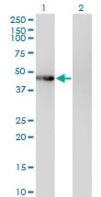 Western Blot: PHKG2 Antibody (2F4) [H00005261-M04]