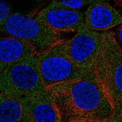 Immunocytochemistry/ Immunofluorescence: PHKG2 Antibody [NBP2-55815]
