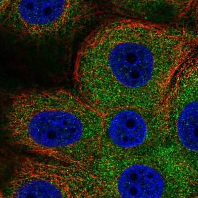Immunocytochemistry/ Immunofluorescence: PHKG2 Antibody [NBP2-56609]