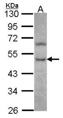 Western Blot: PHKG2 Antibody [NBP2-19802]